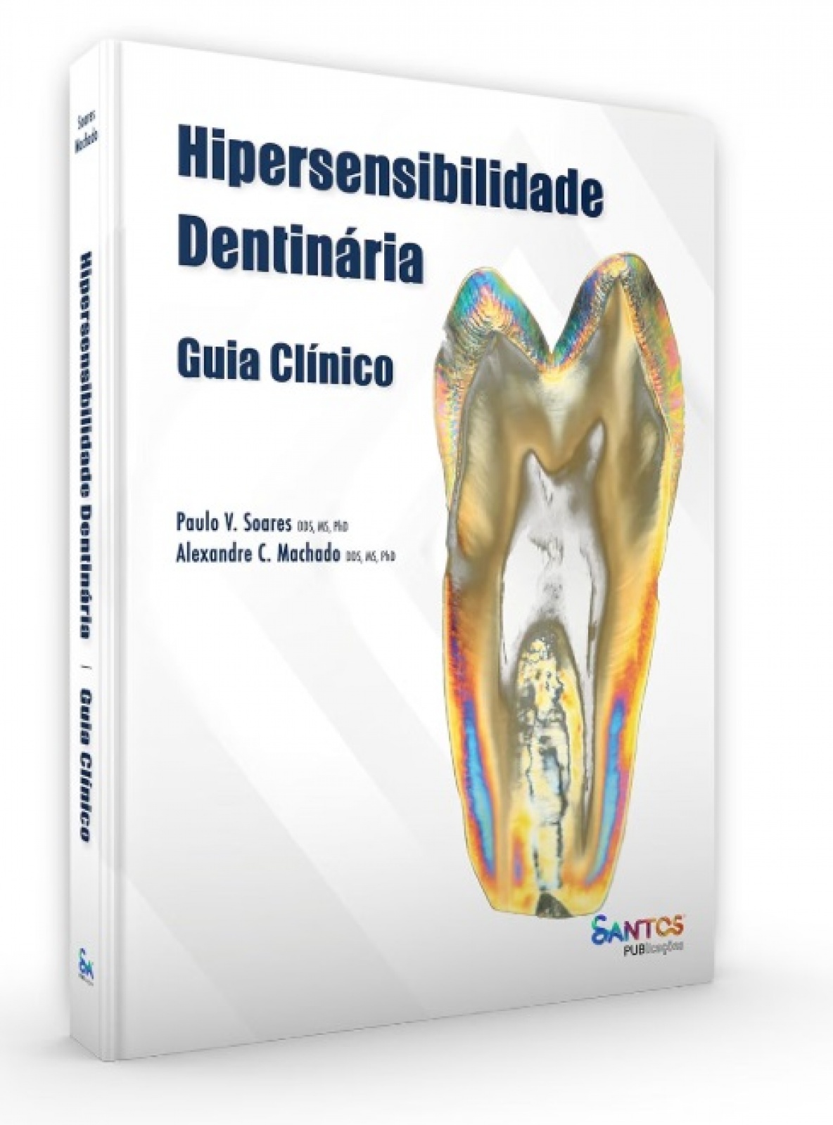 Hipersensibilidade Dentinária Guia Clínico