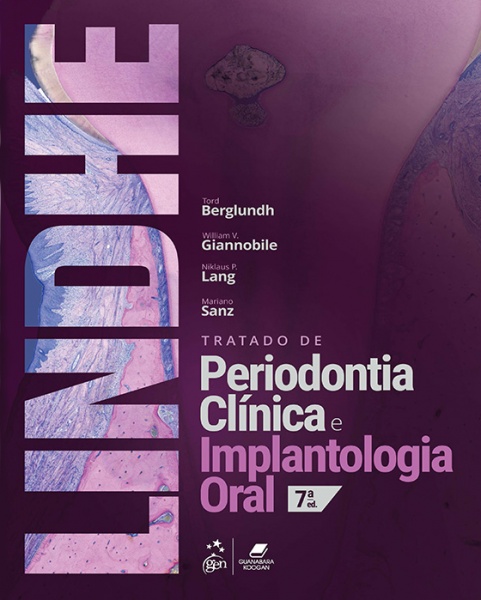 Tratado De Periodontia Clínica E Implantologia Oral - Lindhe