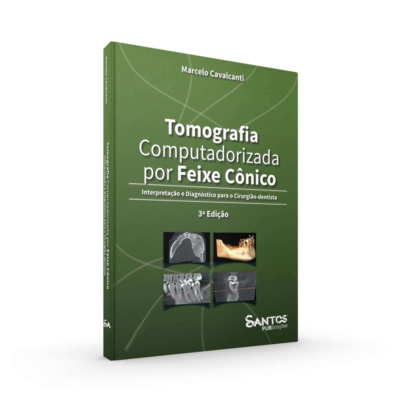 Tomografia Computadorizada Por Feixe Cônico - Interpretação E Diagnóstico Para O Cirurgião-Dentista - 3ª Edição