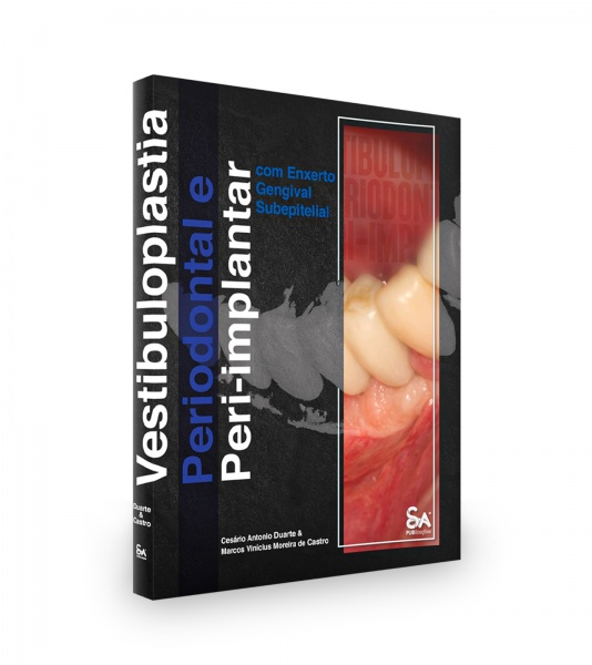 Vestibuloplastia Periodontal E Peri-Implantar Com Enxerto Gengival Subepitelial