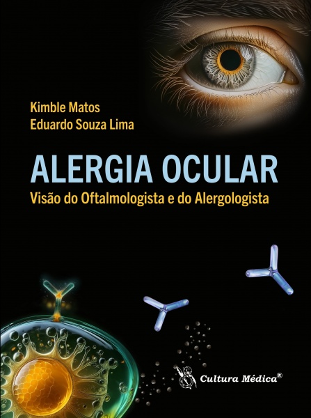 Alergia Ocular – Visão Do Oftalmologista E Do Alergologista