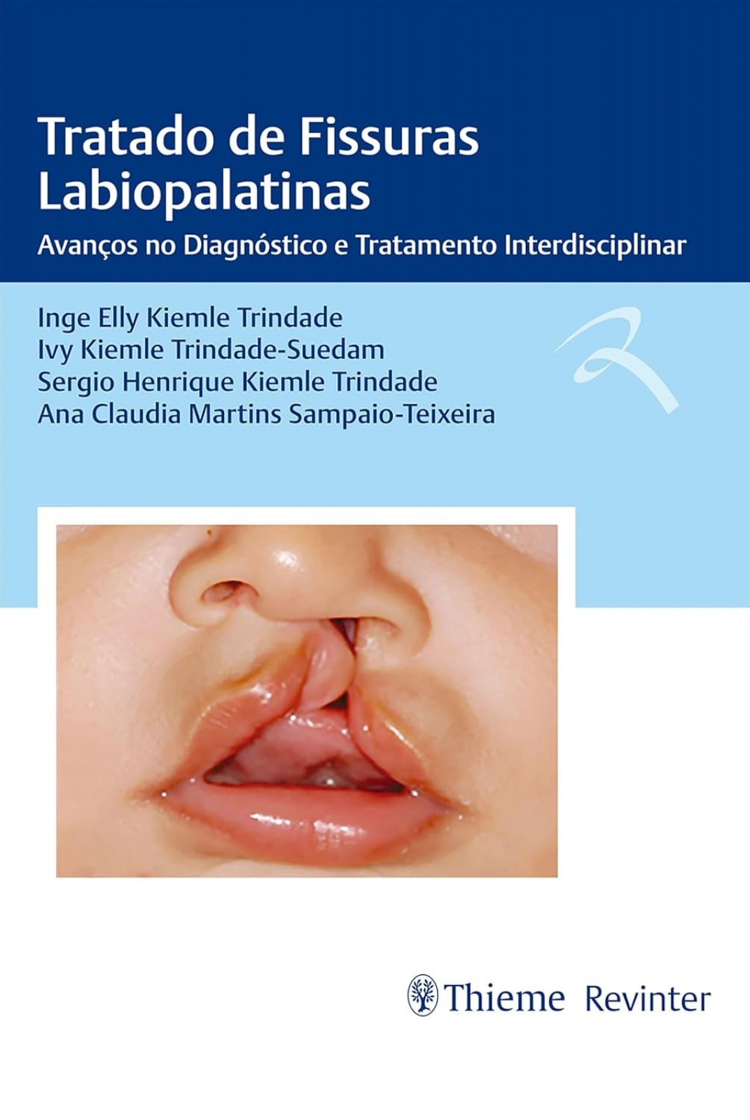 Tratado De Fissuras Labiopalatinas - Avanços No Diagnóstico E Tratamento Interdisciplinar 