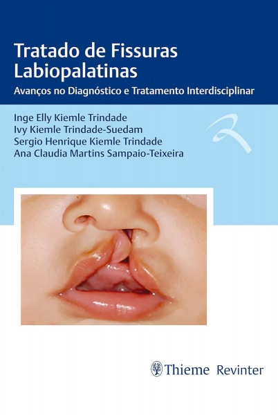 Tratado De Fissuras Labiopalatinas - Avanços No Diagnóstico E Tratamento Interdisciplinar 