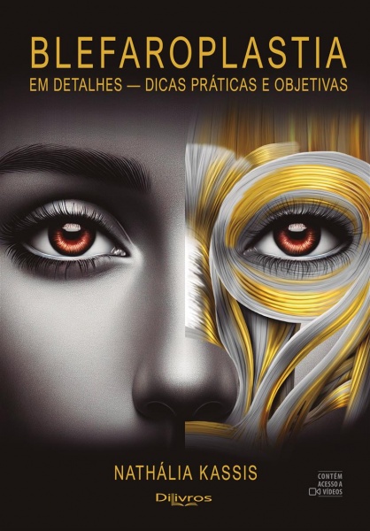 Blefaroplastia Em Detalhes Dicas Praticas E Objetivas