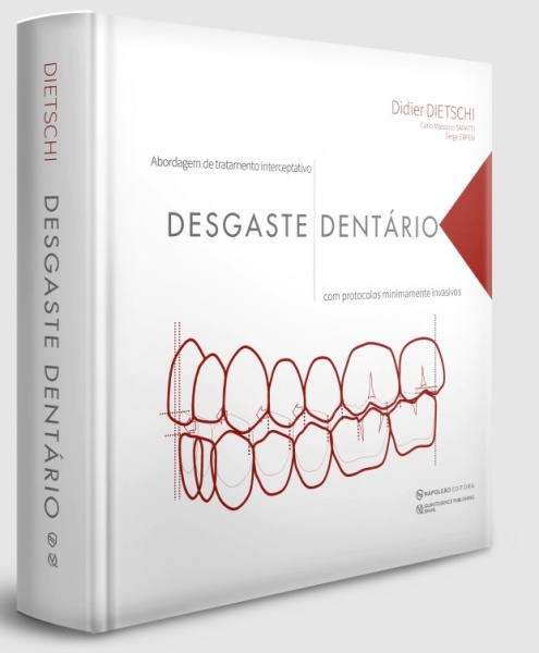 Desgaste Dentário - Abordagem De Tratamento Interceptativo Com Protocolos Minimamente Invasivos