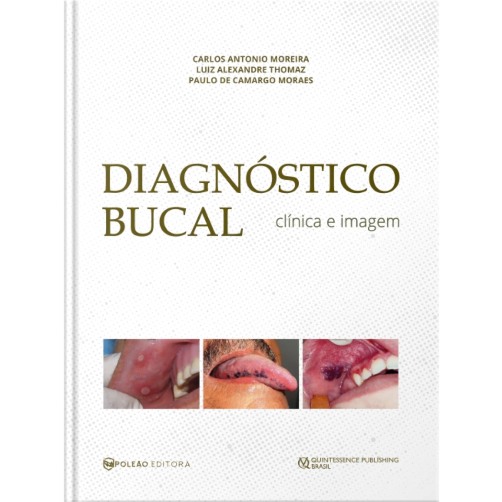 Diagnóstico Bucal Clínica E Imagem