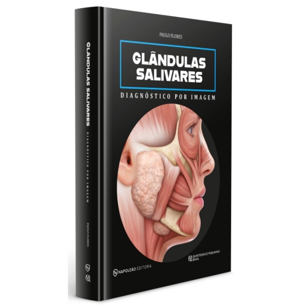 Glândulas Salivares Diagnóstico Por Imagem