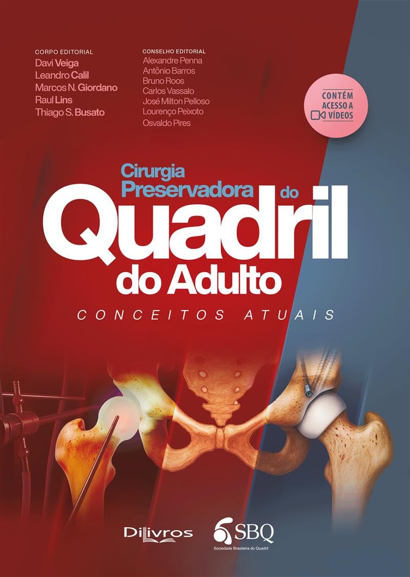 Sbq Cirurgia Preservadora Do Quadril Do Adulto: Conceitos Atuais