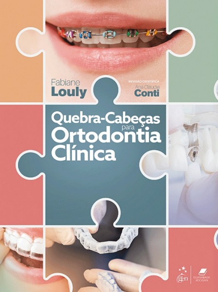 Quebra-Cabeças Para Ortodontia Clínica