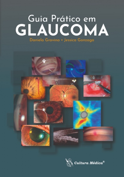 Guia Prático Em Glaucoma