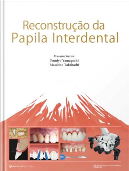 Reconstrução Da Papila Interdental
